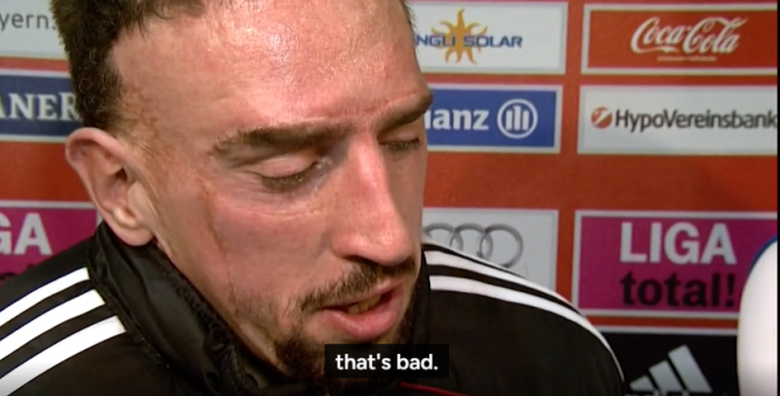 image.png 리베리가 로벤 죽빵 날렸던 사건 .jpg